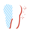 Zahnarzt Schwalmtal-Lobberich - Bleeching